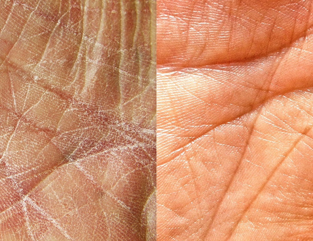 Finite le mani secche con questo trucco che rivoluzionerà il vostro inverno!