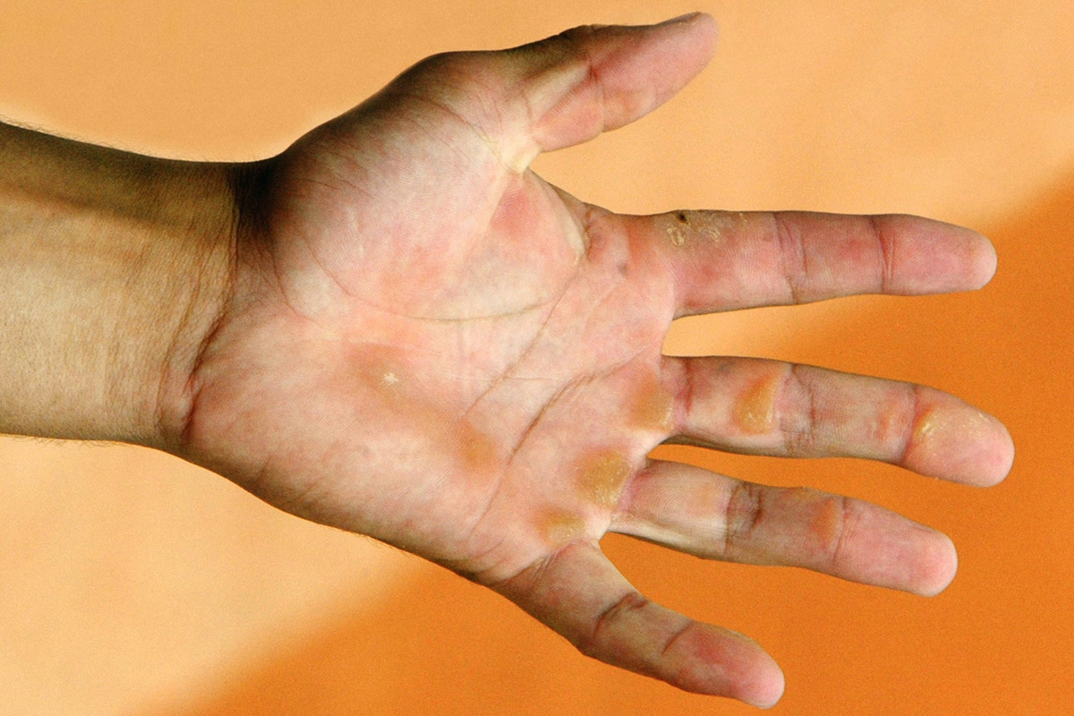 Finite le mani secche con questo trucco che rivoluzionerà il vostro inverno!